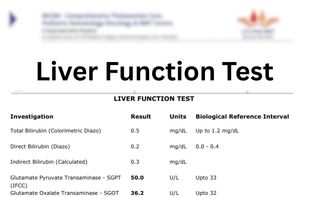 Liver Function Test Report Sample