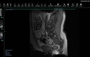 Integrated DICOM Viewer