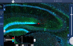 Integrated web-viewer to view slides with their annotations, channels, label, and many more additional information.