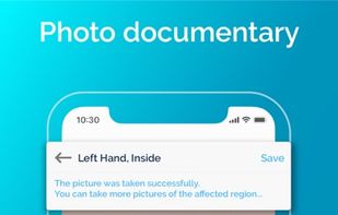 Nia - The eczema App screenshot 1
