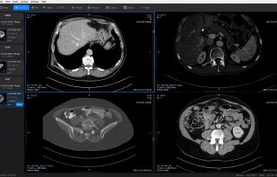 DICOM study comparison in a four-panel layout.