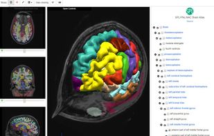 Open Anatomy screenshot 1