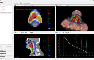 OpenTPS screenshot 1