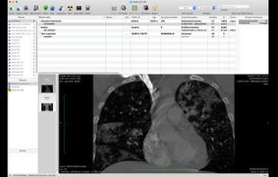 Miele-LXIV screenshot 1