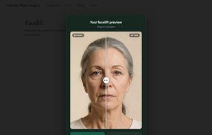 The widget running on a practice's own website, under their branding. One photo in, a photorealistic before and after roughly three to four minutes later, with a drag slider to compare.