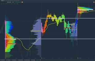TPO Profile Chart (Market Profile)