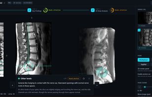 Scan Analysis