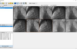 Rubo DICOM Viewer screenshot 1