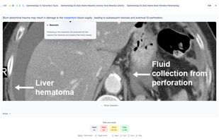 Enhance generated cards or imported decks with keyword highlighting - all done automatically