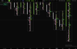 Footprint chart — bid×ask volume, delta and imbalance at every price level, with volume profile and live DOM, on MNQ futures.
