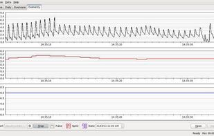 SleepyHead screenshot 1