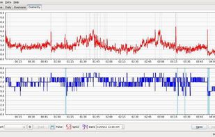 SleepyHead screenshot 1