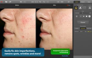 Snapheal screenshot 2