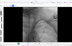 SoftDicom screenshot 1