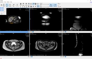 Starviewer screenshot 1