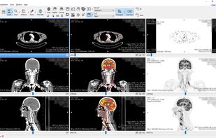 Starviewer screenshot 1