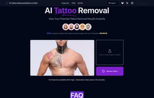 Tattoo Removal