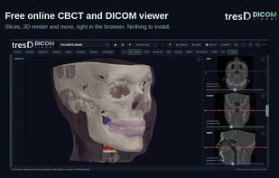 tresD DICOM viewer screenshot 1
