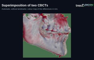 tresD DICOM viewer screenshot 2