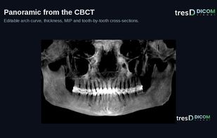 tresD DICOM viewer screenshot 1