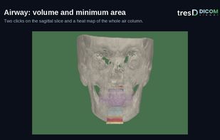 tresD DICOM viewer screenshot 3