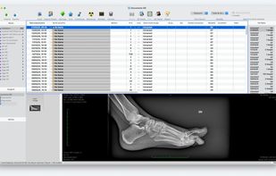 Patient study archive with anonymised entries and an integrated DICOM image preview.