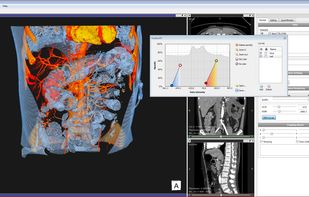 Vesalius3D screenshot 1
