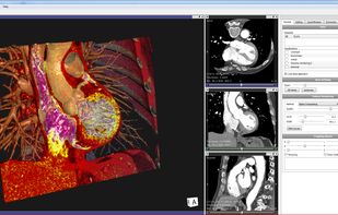 Vesalius3D screenshot 2